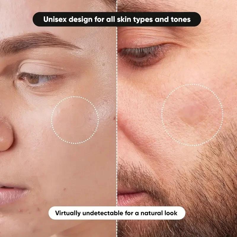 360 pieces/box acne patches -  - Essential Oils 评论和价格